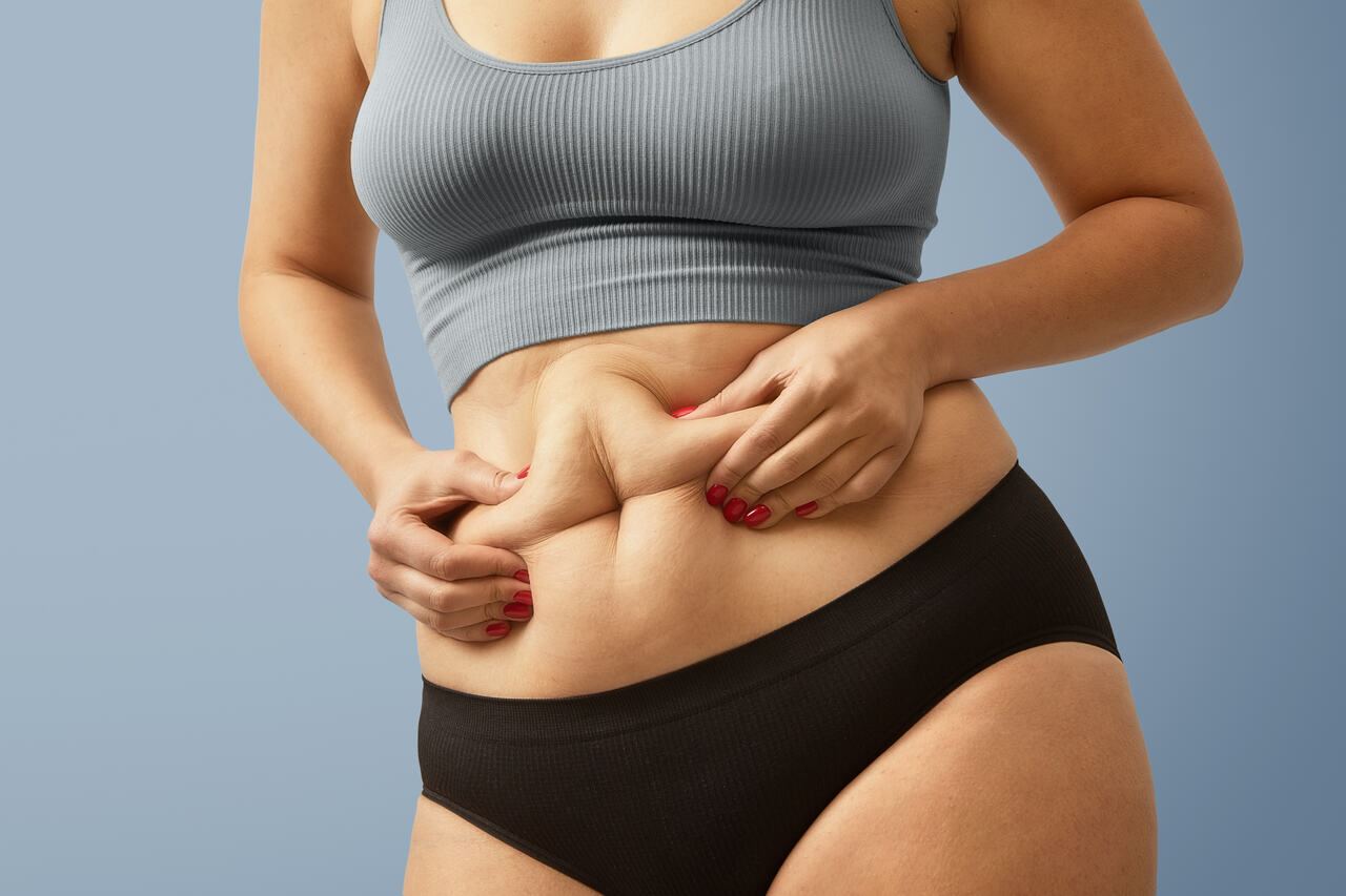 Dr. Marcelo Soares Cirurgião Plástico Goiânia - Quem é o candidato ideal para Abdominoplastia?