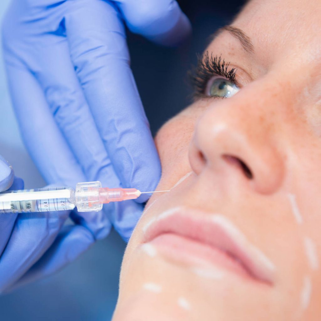 Preenchimentos e biostimuladores- Dr.Marcelo Soares Cirurgião plástico Goiânia