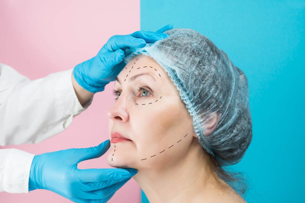 Qual é o tempo de recuperação após o lifting facial Deep Plane e quais cuidados são necessários?